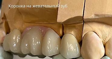 протезы: Врачи, Клиника, Лаборатория, диагностический центр | Стоматолог | Протезирование — 3