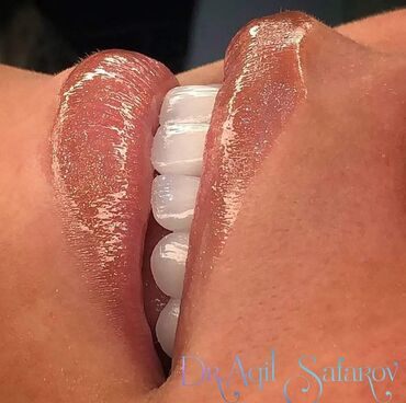 Stomatologiya: 💫Ramazan ayı ilə əlaqədar Kampaniya✨🌟⭐💫 🌊🔥Diş Həkimi 🔥🌊 Qiymətləri — 3