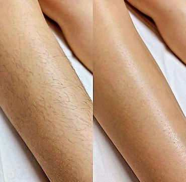 Эпиляция: Восковая депиляция для женщин и мужчин Подмышки - 500 сом — 10