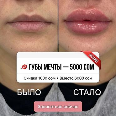 Перманентный макияж: Акварельный перманентный макияж губ - Естественное выравнивание тона — 14