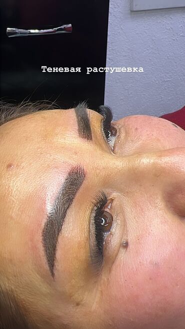 Косметология: Косметология, Биоревитализация, Ботокс, Демодекоз, Гипоаллергенные материалы, Консультация, Сертифицированный косметолог — 32