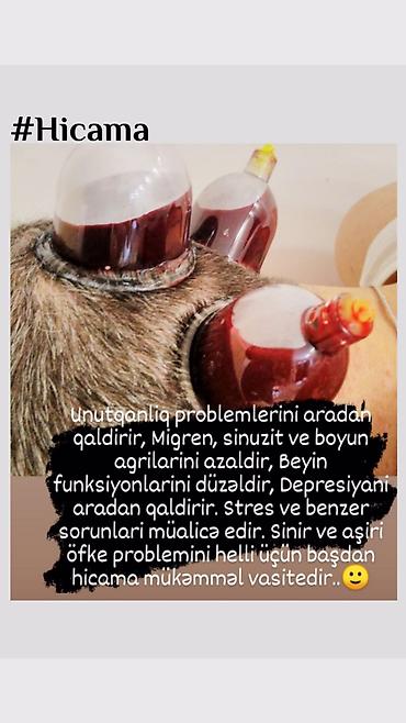 ariqlama: Bəylər üçün = Lazer Epilasiyasi✅Hicama və Zəli✅Masaj✅Çistka✅Ayaq — 9