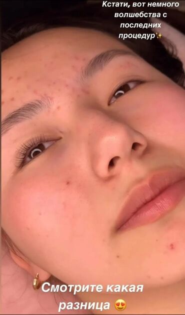 Ресницы: Ресницы, Классика, 2D, 3D, С выездом на дом, Консультация, Гипоаллергенные материалы — 7