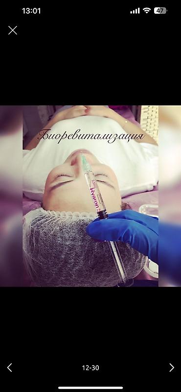 Косметология: Косметология, Ботокс, Биоревитализация, Ботулинотерапия, Консультация, Гипоаллергенные материалы, Сертифицированный косметолог at lalafo.kg — 33 Косметология: Косметология, Ботокс, Биоревитализация, Ботулинотерапия, Консультация, Гипоаллергенные материалы, Сертифицированный косметолог — 33