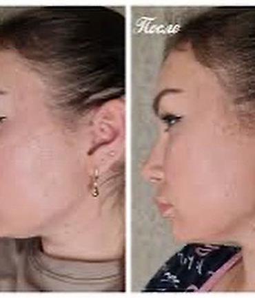 черный маска: Косметический бандаж для подтяжки лица, подбородка предназначен — 6