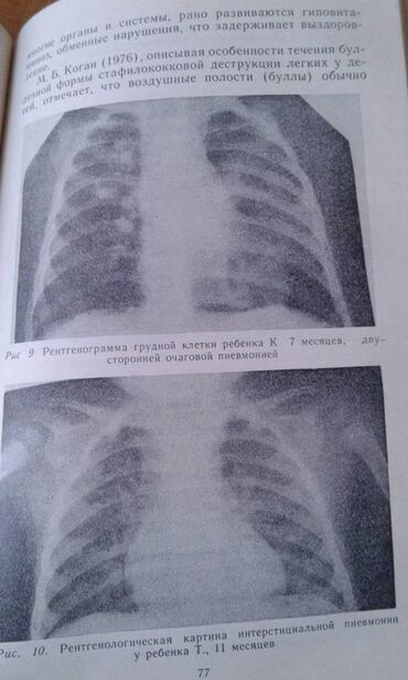 Digər kitablar və jurnallar: Продаются разные книги: "Как вырастить здорового ребенка". 40 манат — 29