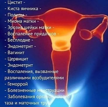 Ginekoloji problemlərin profilaktikası və dəstəyi üçün xidmət/paket
