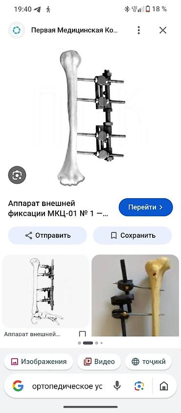 мед бишкек: Аппарат внешней фиксации кости (тип МКЦ‑01/универсальный модуль). - — 1