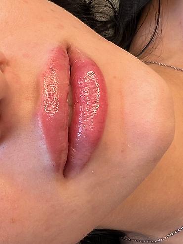 Косметология: Косметология, Ботокс, Биоревитализация, Ботулинотерапия, Консультация, Гипоаллергенные материалы, Сертифицированный косметолог at lalafo.kg — 14 Косметология: Косметология, Ботокс, Биоревитализация, Ботулинотерапия, Консультация, Гипоаллергенные материалы, Сертифицированный косметолог — 14