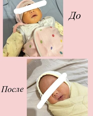 средство от клопов бишкек: Фототерапия для новорождённых MAIENENG — портативная голубая