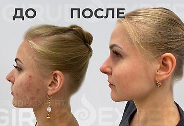 Косметология: Косметология, Пилинг, Демодекоз, Лифтинг, Консультация, Сертифицированный косметолог, Гипоаллергенные материалы — 10