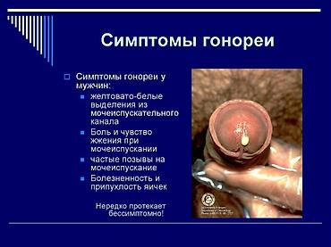 простатит: Врачи | Уролог | Консультация, Диагностика — 5