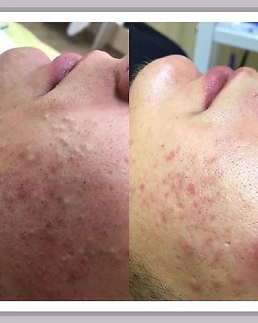 Косметология: Косметология, Чистка кожи, Массаж лица, Лечение угревой болезни, С выездом на дом, Сертифицированный косметолог, Консультация — 7