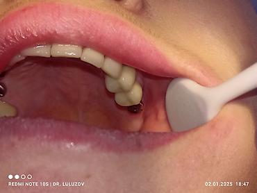 Медицинские услуги: Клиника | Стоматолог | Протезирование — 9