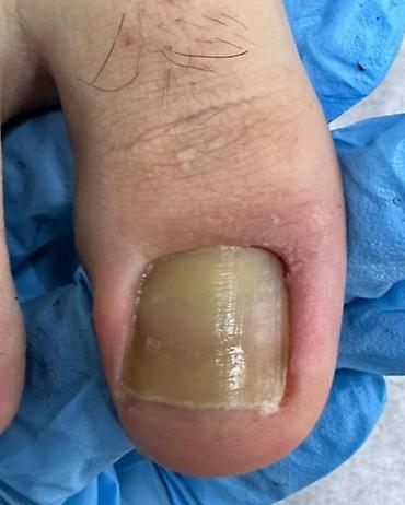 Маникюр: Ремонт сломаных ногтей, Наращивание ногтей, Донаращивание ногтей, Услуги подолога, Маникюр, Педикюр, Консультация, Одноразовые расходные материалы — 7