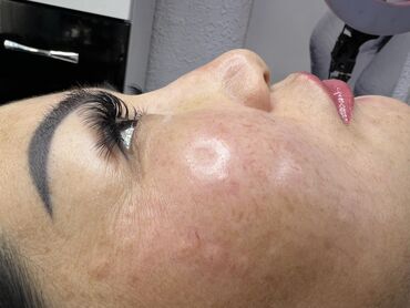 Косметика: Процедура перманентного макияжа губ позволяет придать губам желаемый — 69