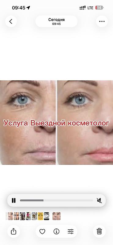 лимфодренажный: Акция на уходовые процедуры!!! ✨ — 1