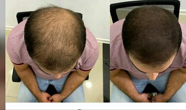 brazil keratin: Saç ustaları | Kişi saç kəsimləri, Qadın saç kəsimləri, Saç rəngləməsi | Evə gəlməklə