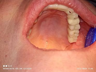 Медицинские услуги: Клиника | Стоматолог | Протезирование — 10