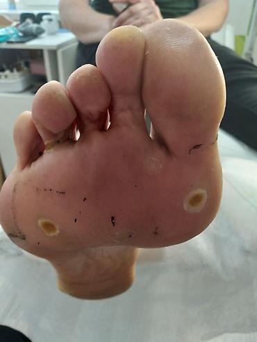 Маникюр: Коррекция вросших ногтей, Педикюр, Услуги подолога, Консультация, Одноразовые расходные материалы — 4