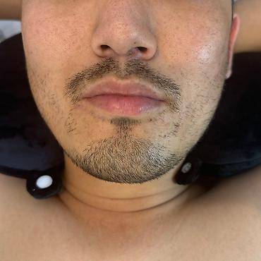 Эпиляция: Мужской шугаринг. Восковая депиляция — 13