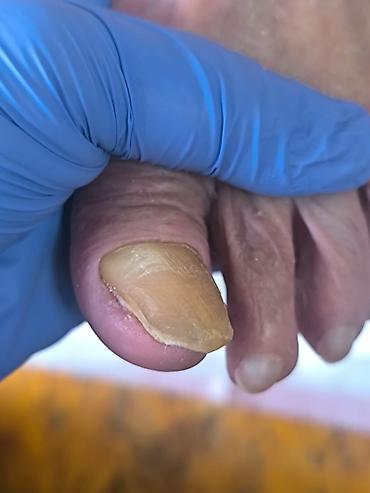 Маникюр: Коррекция вросших ногтей, Маникюр, Педикюр, Услуги подолога, С выездом на дом, Консультация, Одноразовые расходные материалы — 7