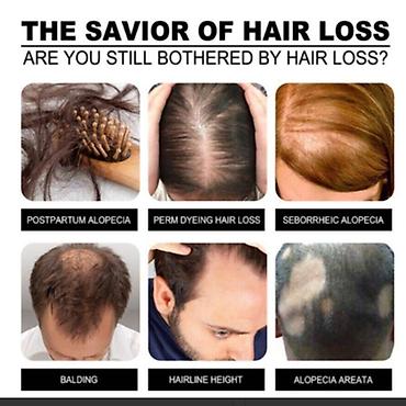 Уход за телом: США От облысения для волос от выпадения волос - смотрим фото читаем — 9