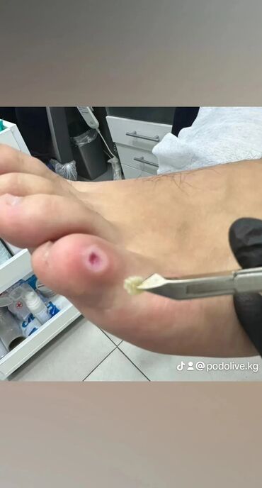 Маникюр, педикюр: Коррекция вросших ногтей, Выравнивание, Услуги подолога, Маникюр, Педикюр, С выездом на дом, Консультация, Одноразовые расходные материалы — 2