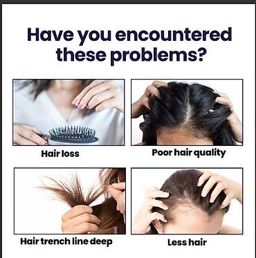 Уход за телом: США против выпадения волос ouhoe от облысения восстанавливающий спрей — 12