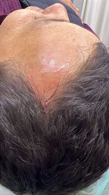 Косметология: Косметология, Ботокс, Биоревитализация, Ботулинотерапия, Консультация, Гипоаллергенные материалы, Сертифицированный косметолог — 17