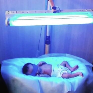 лампа для лечения желтухи новорожденных: Фотолампа от желтухи. Фотолампы Philips! (Для лечения желтушки