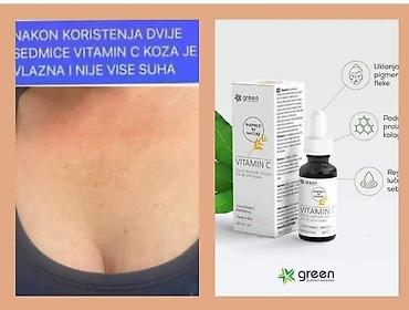 venom: Vitamin C je sastojak koji je postao nezaobilazan korak u svakodnevnoj — 1