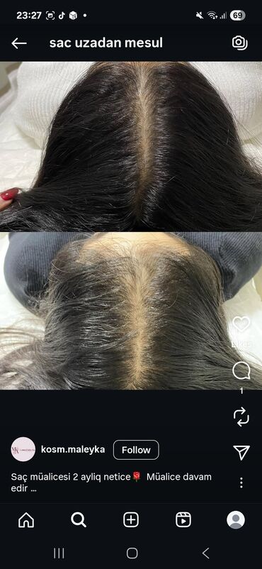 Saçlara qulluq: Saç üçün yağ, Saç tökülməsinə qarşı — 27