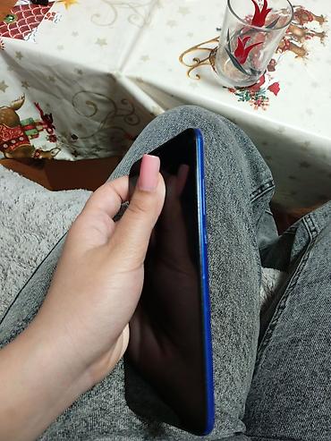 rədmi 7: Xiaomi Redmi (mavi rəng). - Ekran: damla tipli ön kamera kəsiyi olan — 3