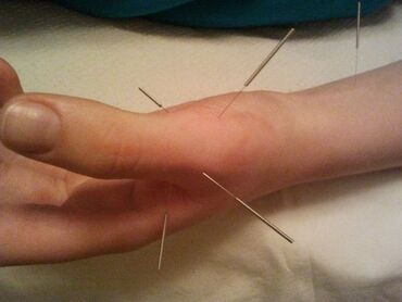 Hicama, zəli: Salam Aleykum.Yalnız Xanımları Hicama edirəm.Naməhrəmlər — 2