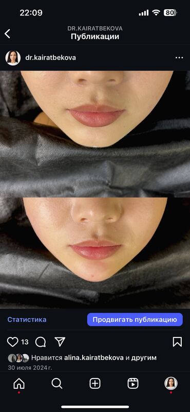 Косметология: Косметология, Биоревитализация, Ботокс, Ботулинотерапия, Требуются модели, Гипоаллергенные материалы, Консультация — 10