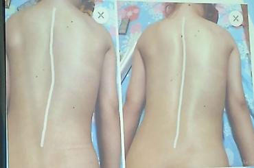 Массаж: Массаж | Лечебный массаж | Остеохондроз, Межпозвоночная грыжа, Кифос, лордоз — 3