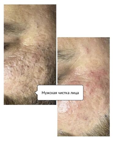 Косметология: Косметология, Пилинг, Ботулинотерапия, Плазмолифтинг, Консультация, Требуются модели, Сертифицированный косметолог — 7