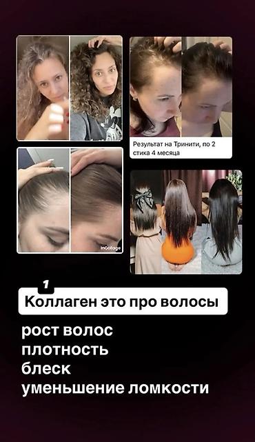 Мед. товарлар: Коллаген, Чачтын өсүшү үчүн, Универсалдуу, Желе, Жаңы — 1