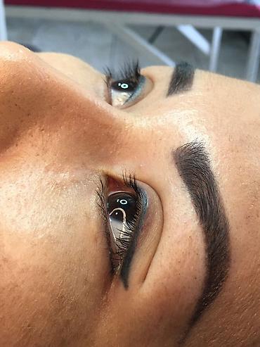 Косметология: Косметология, Ботокс, Биоревитализация, Ботулинотерапия, Консультация, Гипоаллергенные материалы, Сертифицированный косметолог — 11