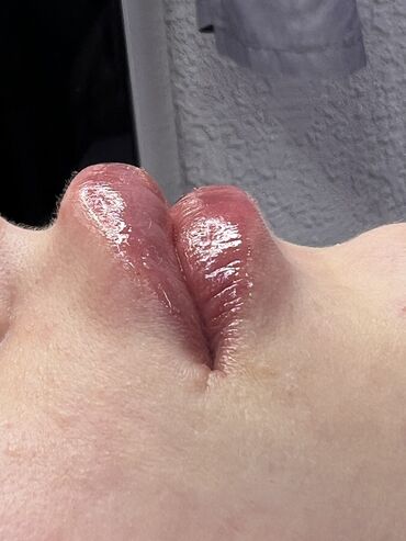 Косметология: Косметология, Ботокс, Биоревитализация, Ботулинотерапия, Консультация, Гипоаллергенные материалы, Сертифицированный косметолог — 5