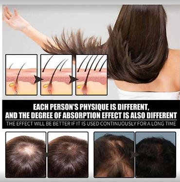 Уход за телом: США для роста волос укрепления роста восстановления уменьшения — 17