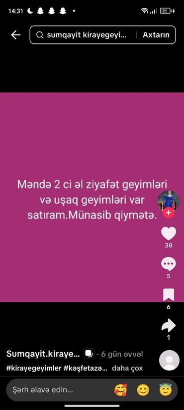 Daş yunu: İkinci əl ziyafət geyimləri və uşaq geyimləri satışa çıxarılıb. Bu