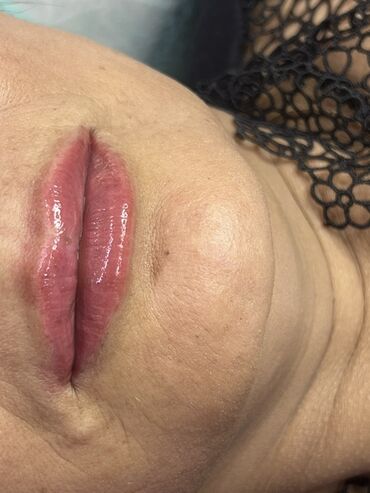 Косметология: Косметология, Маски, Мезотерапия, Удаление носогубных складок, Гипоаллергенные материалы, Консультация, Сертифицированный косметолог — 8