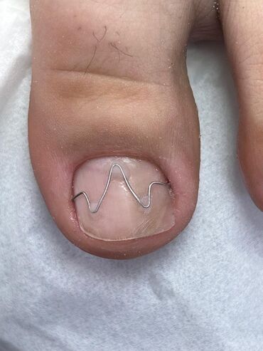 Маникюр, педикюр: Ремонт сломаных ногтей, Снятие, Укрепление ногтей, Услуги подолога, Одноразовые расходные материалы, Консультация, С выездом на дом — 3