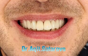 Stomatologiya: 💫Ramazan ayı ilə əlaqədar Kampaniya✨🌟⭐💫 🌊🔥Diş Həkimi 🔥🌊 Qiymətləri — 6