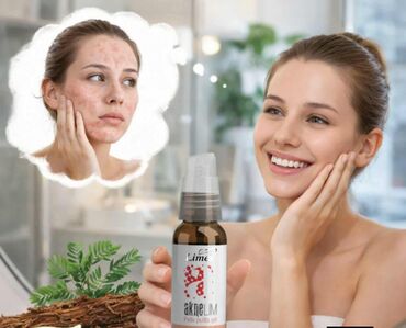 Nega kože: Aknelim gel 30ml – 100% delotvoran saveznik protiv akni Iskoristite — 1