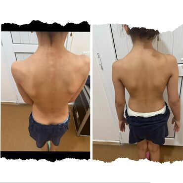 Hicama, zəli: Xidmət: Kupa terapiyası (quru və yaş/hicama), bel–boyun–çiyin masajı — 10