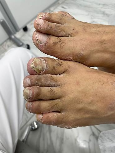 мужской педикюр бишкек: Педикюр, Одноразовые расходные материалы — 1
