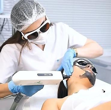 Gözəllik və estetika avadanlığı: Carbon Lazer, Carbon peeling Digər aparatlardan fərqi effektli və — 2